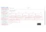 setup facebook pixel conversion API capi and server side tracking via GTM